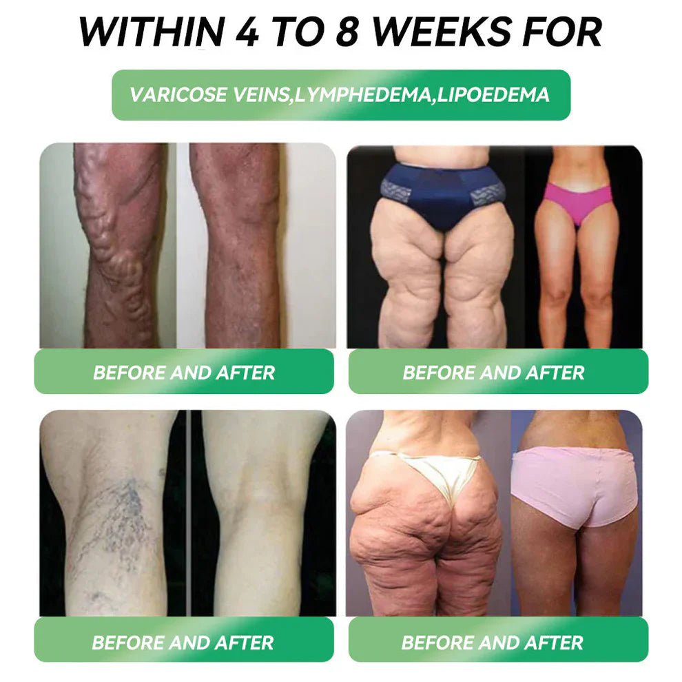 Persistence=Results!Enjoy a limited-time 30% discount on HHVB.Many customers opt to purchase six boxes at once (a 42-day supply) – not only does this consolidate results, but it also secures you a fantastic value bundle! 👍